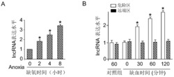 一种含lncRNA抑制剂的药物组合物及其用途