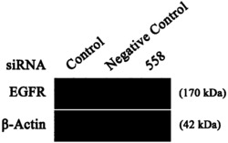 抑制EGFR基因表达的siRNA及其应用