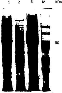 一种鸡柔嫩艾美尔球虫微线蛋‑2突变体EtMIC2‑1130