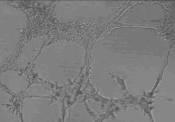 一种肿瘤血管新生抑制剂己啉酮及其制备方法和用途