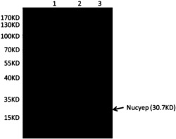 一种Nucyep的编码基因、重组表达载体、重组工程菌及其制备方法和应用