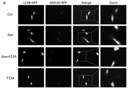 siRNA-GOLPH3在制备预防或治疗心肌细胞肥大药物中的应用