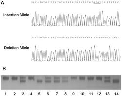 基于STAT5A基因插入缺失多态性位点的心源性猝死易感性检测试剂盒