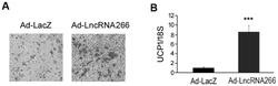 LncRNA-266在制备诱导棕色脂肪细胞分化药物中的应用