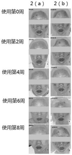 美白消炎面膜液