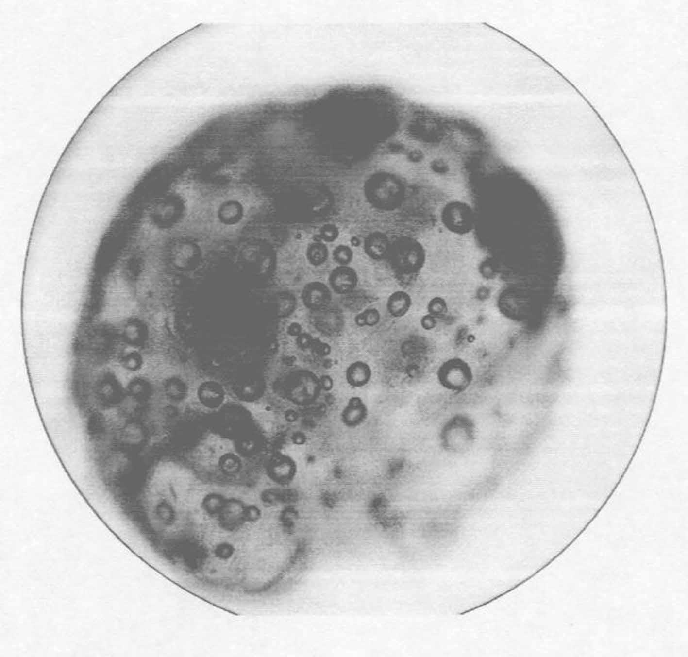 一种土壤修复用固体复合微生物微球及其制备方法