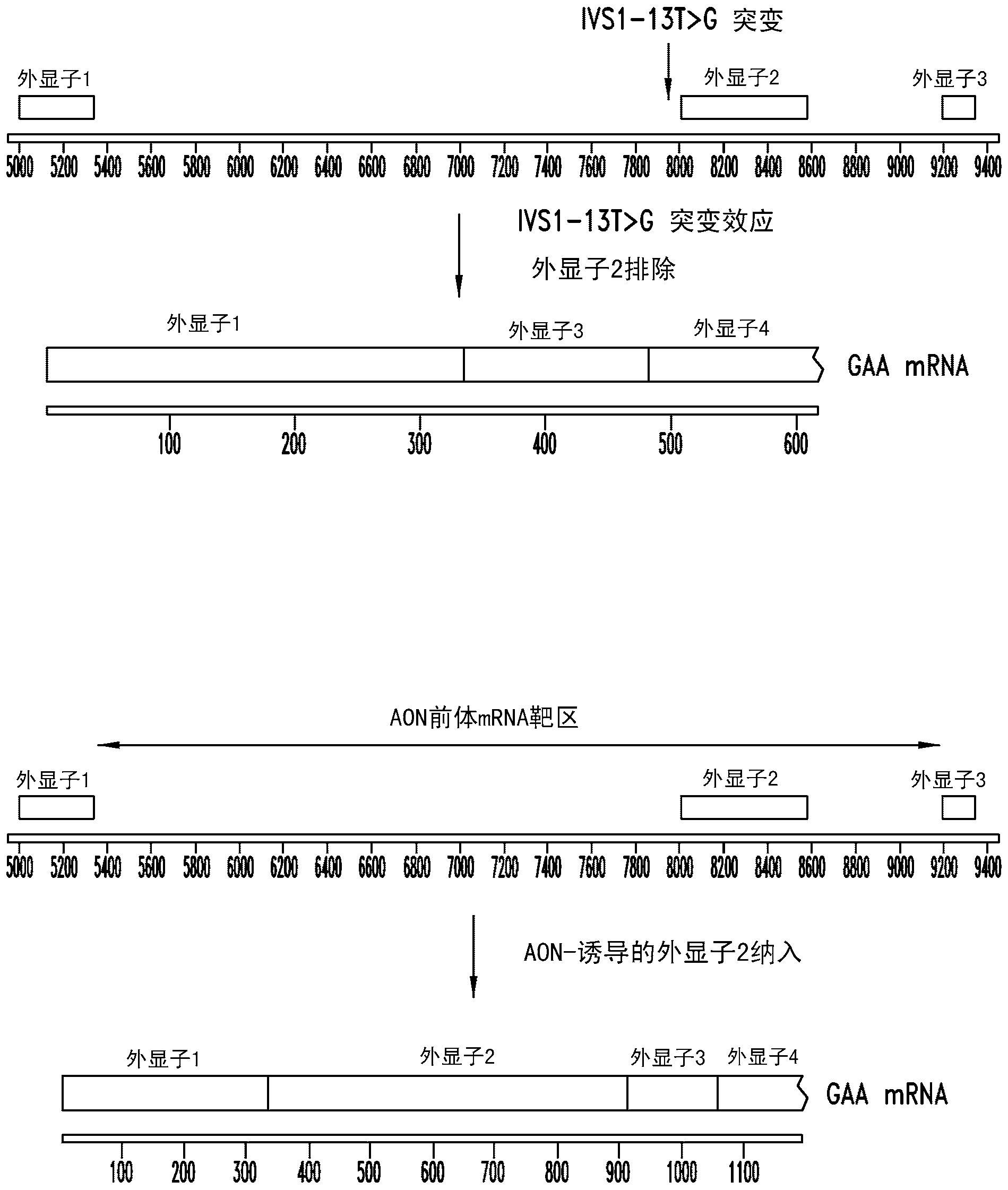 酸性α-葡糖苷酶中反义诱导的外显子2纳入