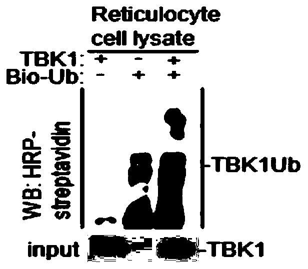 TBK1作为E3泛素连接酶的应用