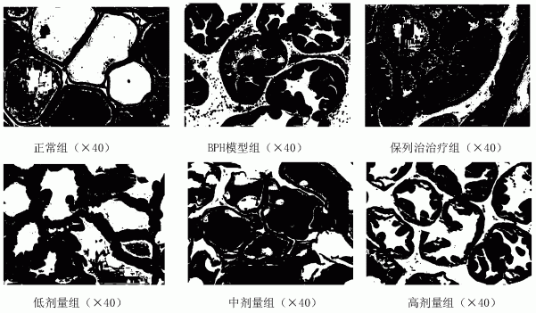 赛葵总黄酮提取物及其制备方法和用途