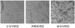 一种治疗手足口病的灵芝多糖复合物及其制备方法