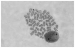 一种利用小分子抑制剂SP600125制备染色体标本的方法